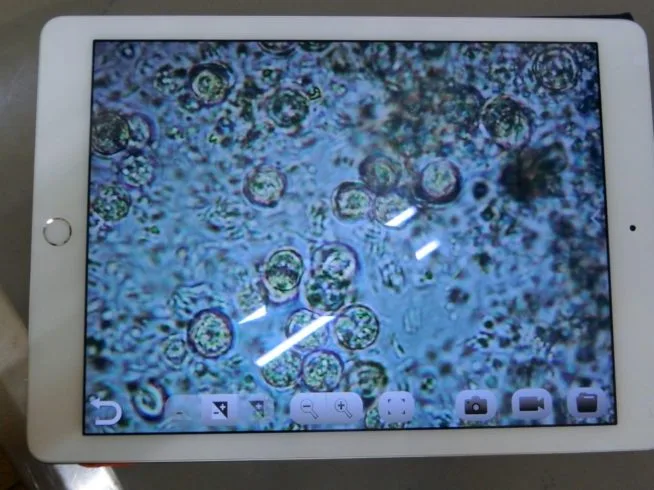 フェレット【コクシジウムとは？】ウンチの変化で見る症状と予防するには？